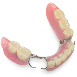 Paramount dentures